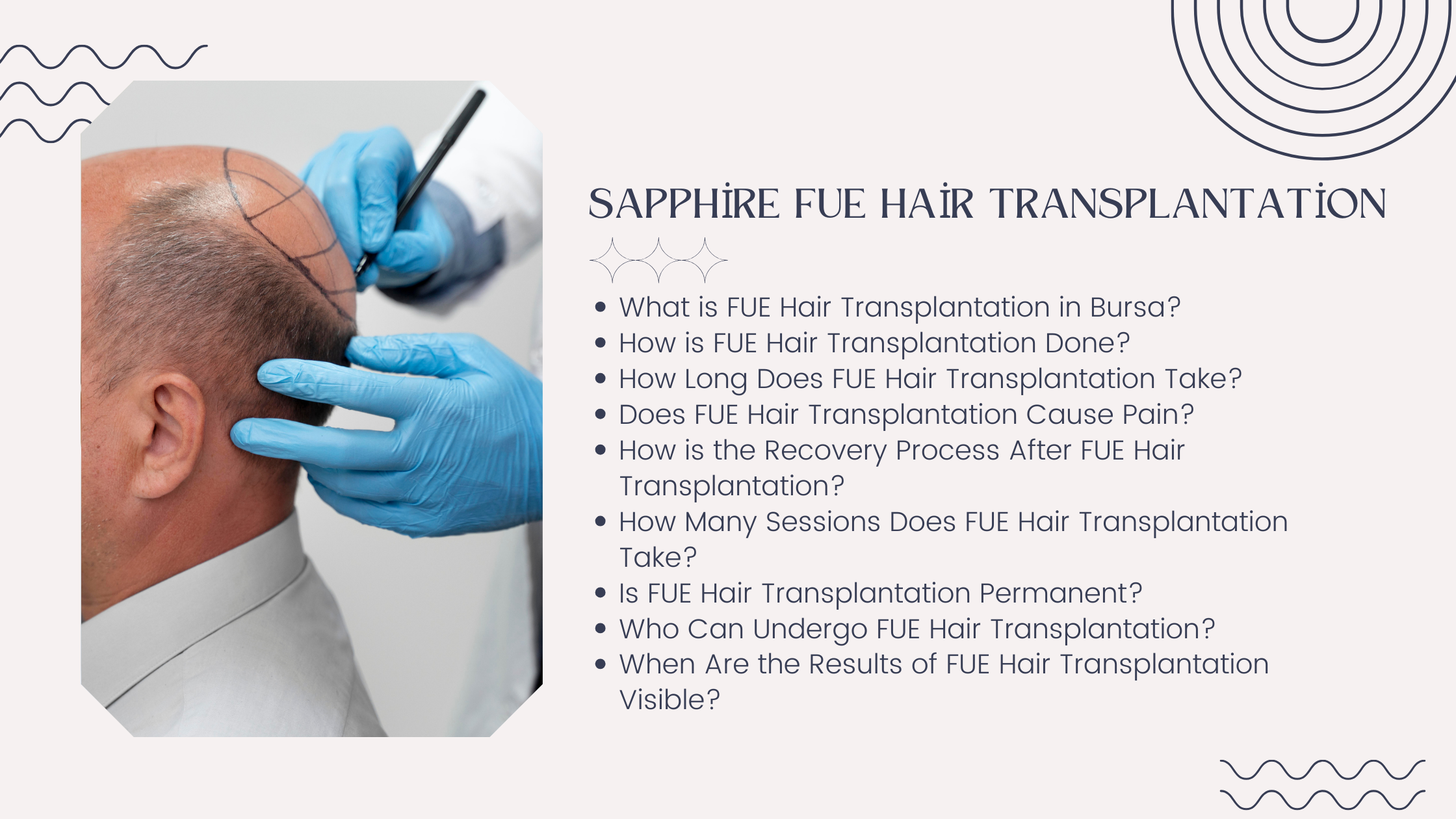 Sapphire Fue Hair Transplantation